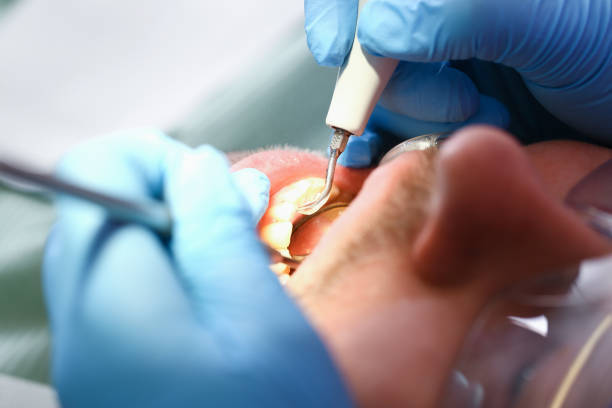 Best Pediatric Emergency Dentist in Sabina, OH