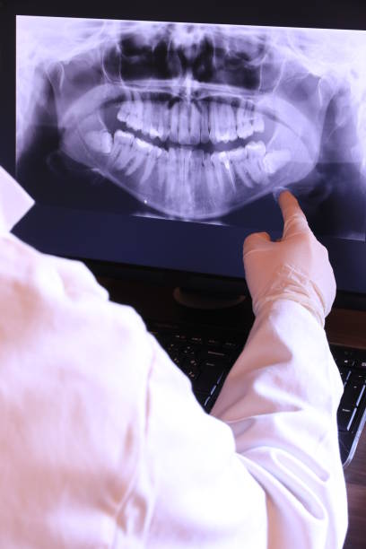 Best Emergency Tooth Extraction in Sabina, OH
