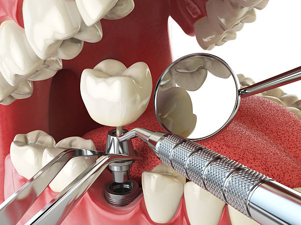Best After-Hours Dental Trauma Care in Sabina, OH